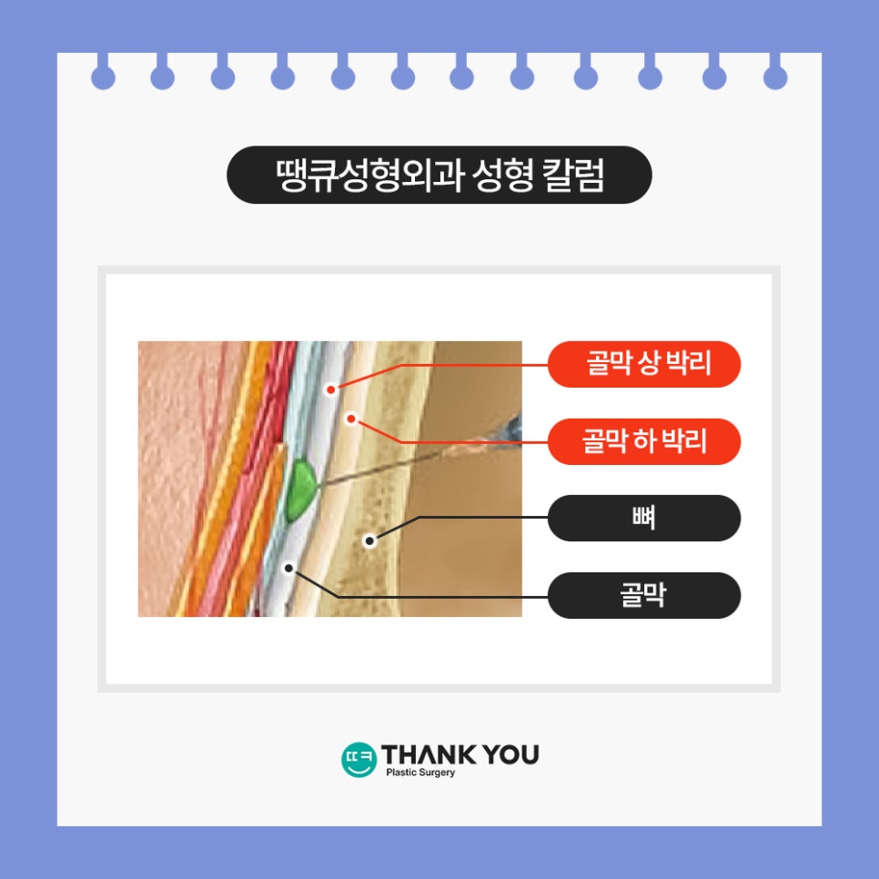 눈밑 필러 넣었는데 눈밑지방재배치 가능할까요? (이호준 칼럼) 관련 이미지 9