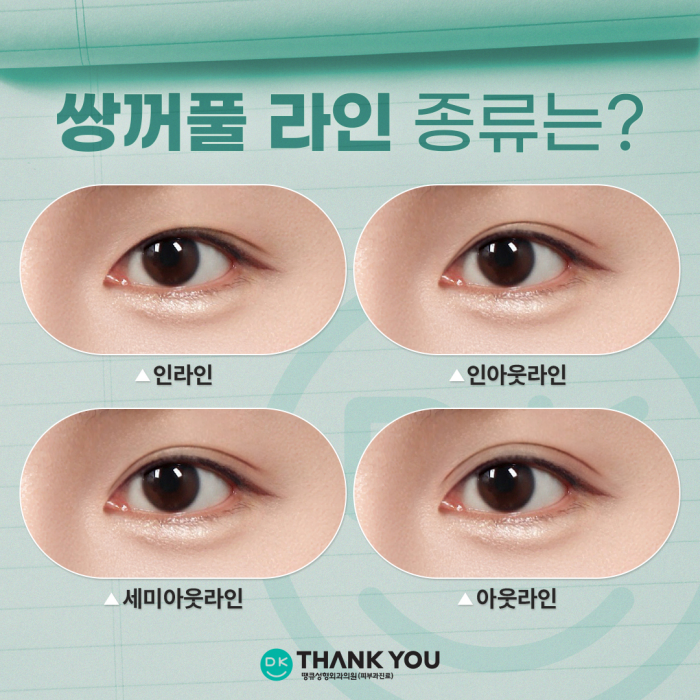 Double-Eyelid Surgery Line: Which One Suits Me Best? image 2