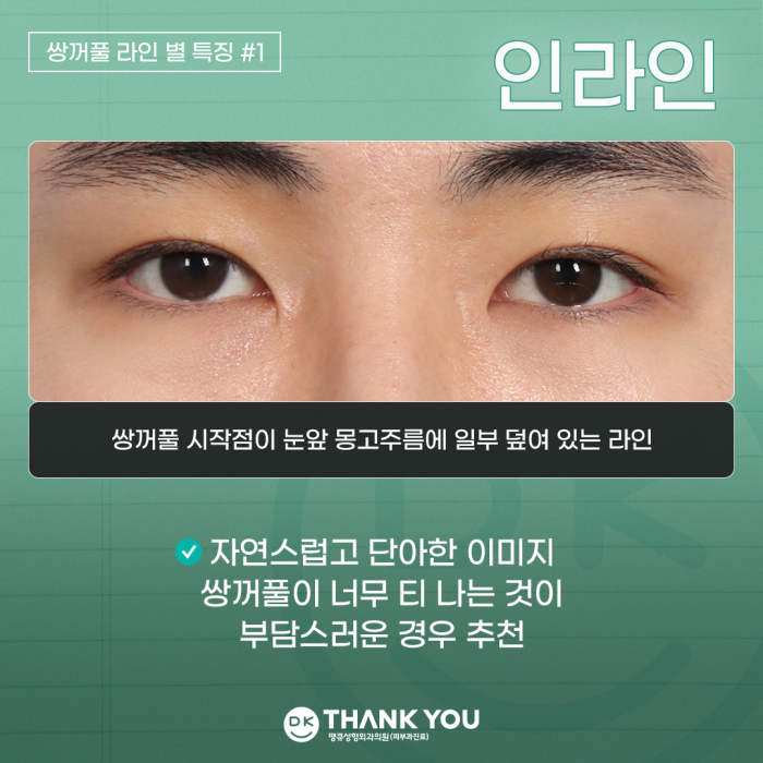 Double-Eyelid Surgery Line: Which One Suits Me Best? image 3