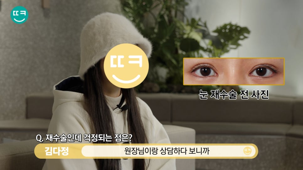 짝눈 쌍수 재수술, 짝짝이 라인과 비대칭쌍꺼풀 대칭 맞추기 관련 이미지 11