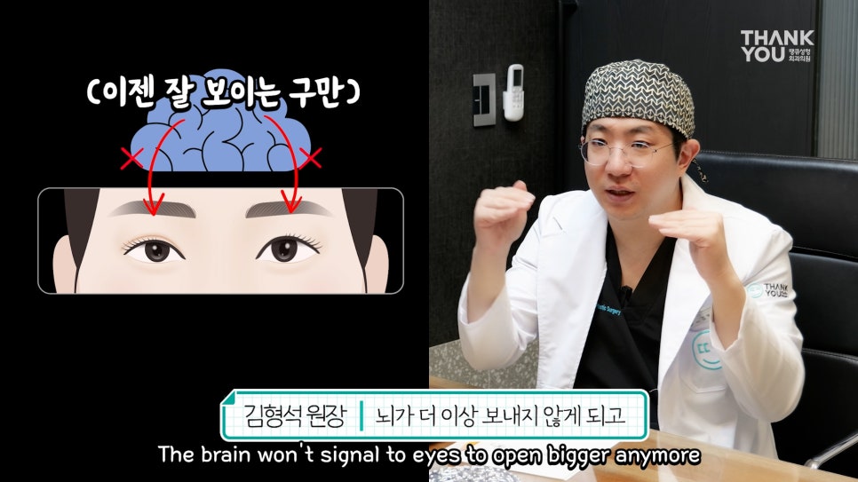 비대칭눈 교정(짝짝이 쌍꺼풀) 헤링의 법칙이란? 관련 이미지 13