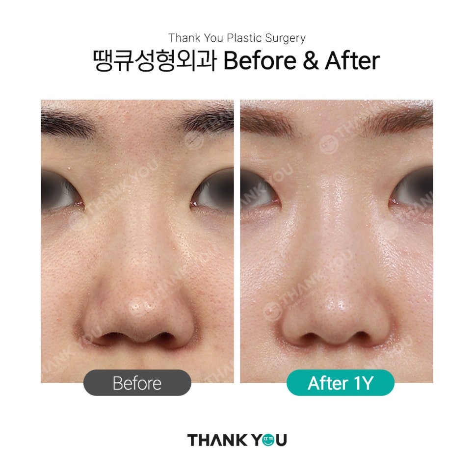 자연스러운 코?직반라인체크+코 비주란? 관련 이미지 4