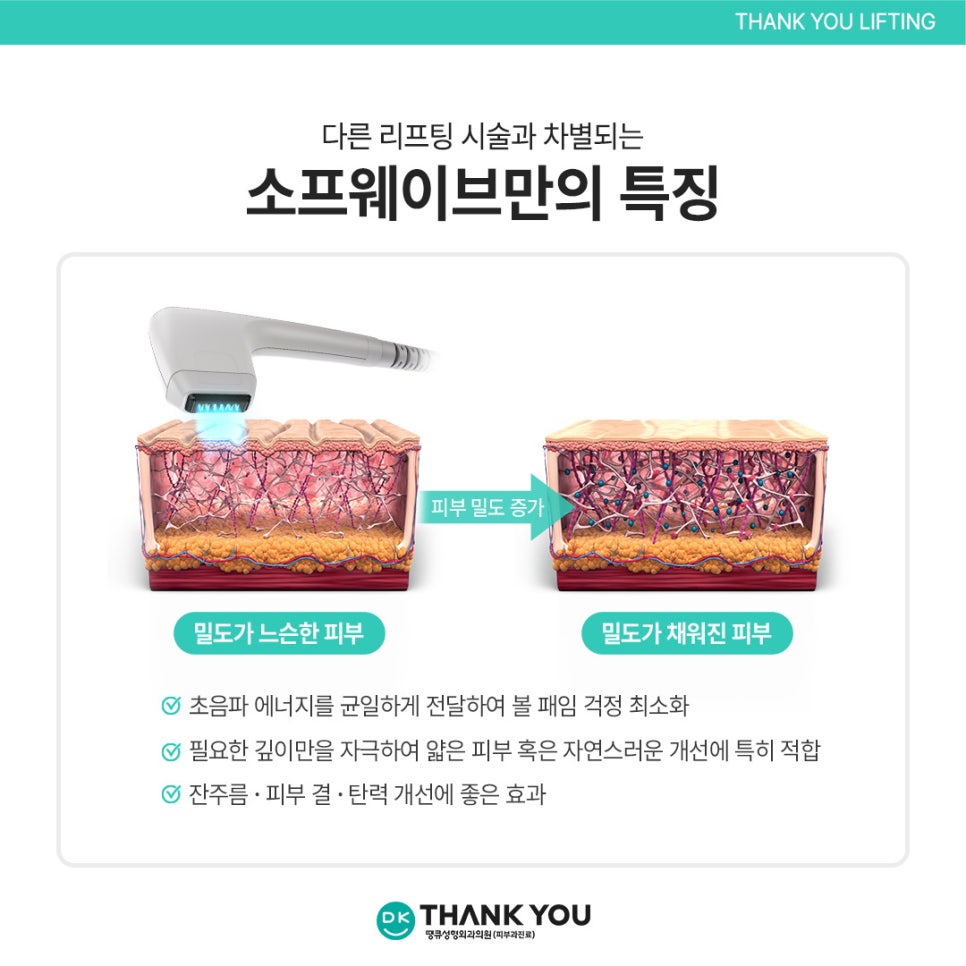소프웨이브시술 효과, 탄력 관리와 주름 개선을 동시에! 관련 이미지 6