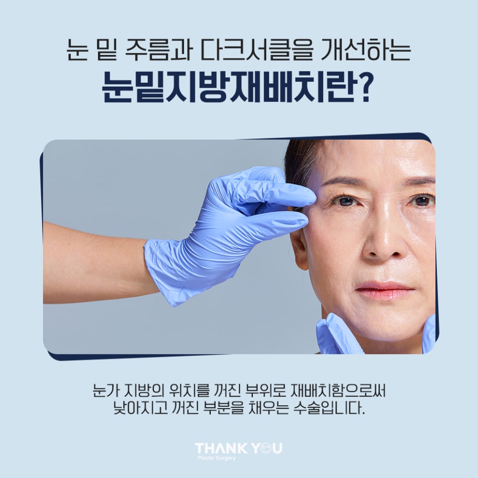 비수술 눈밑성형, 레이저 눈밑지방재배치란? 관련 이미지 3