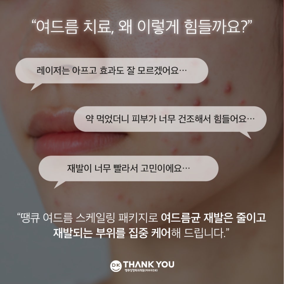 Curious About the Effects of Acne Scaling? Find Out at Thank You! image 2