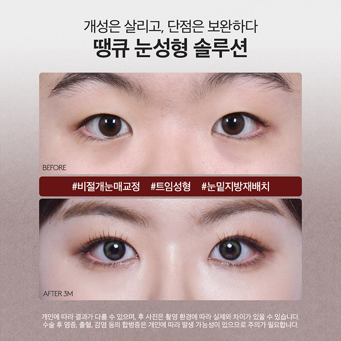 맥미걸 관련 이미지 6