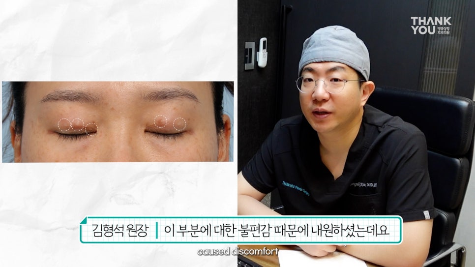 눈꺼풀에 딱딱한 여드름? 육아종 제거 [비절개] 관련 이미지 7