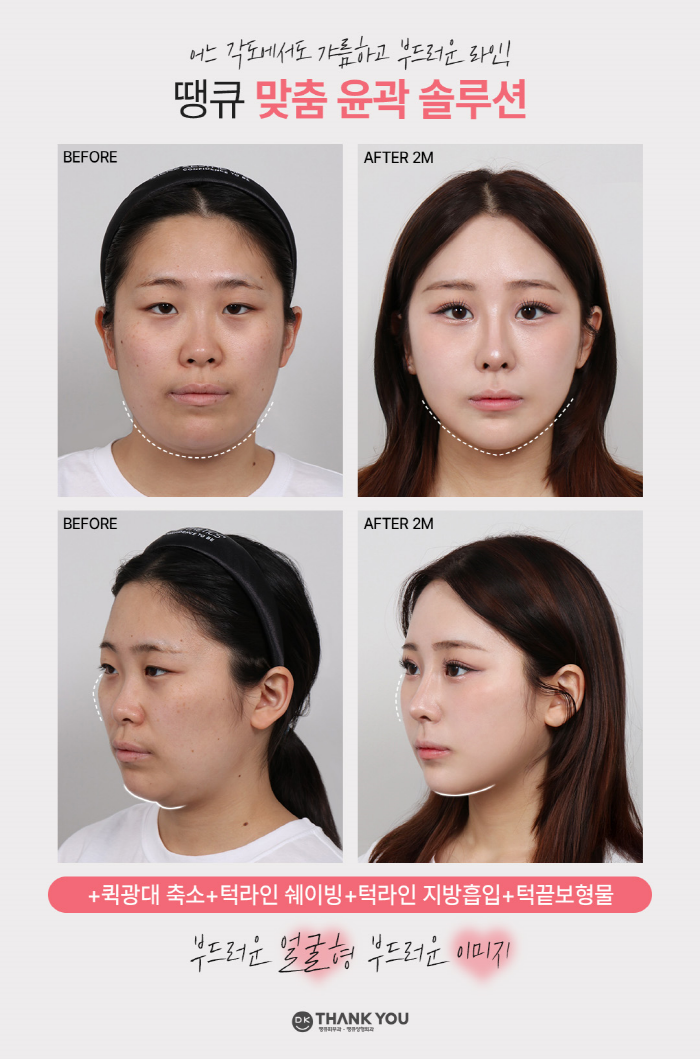 맥미걸 관련 이미지 5