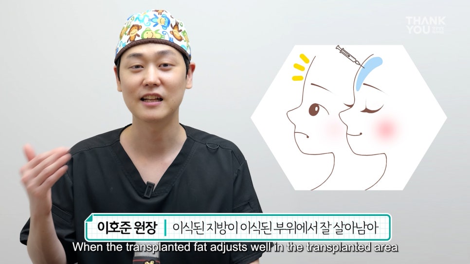 눈밑지 후기 성공하려면, 앞광대지방이식 필수?! 관련 이미지 15