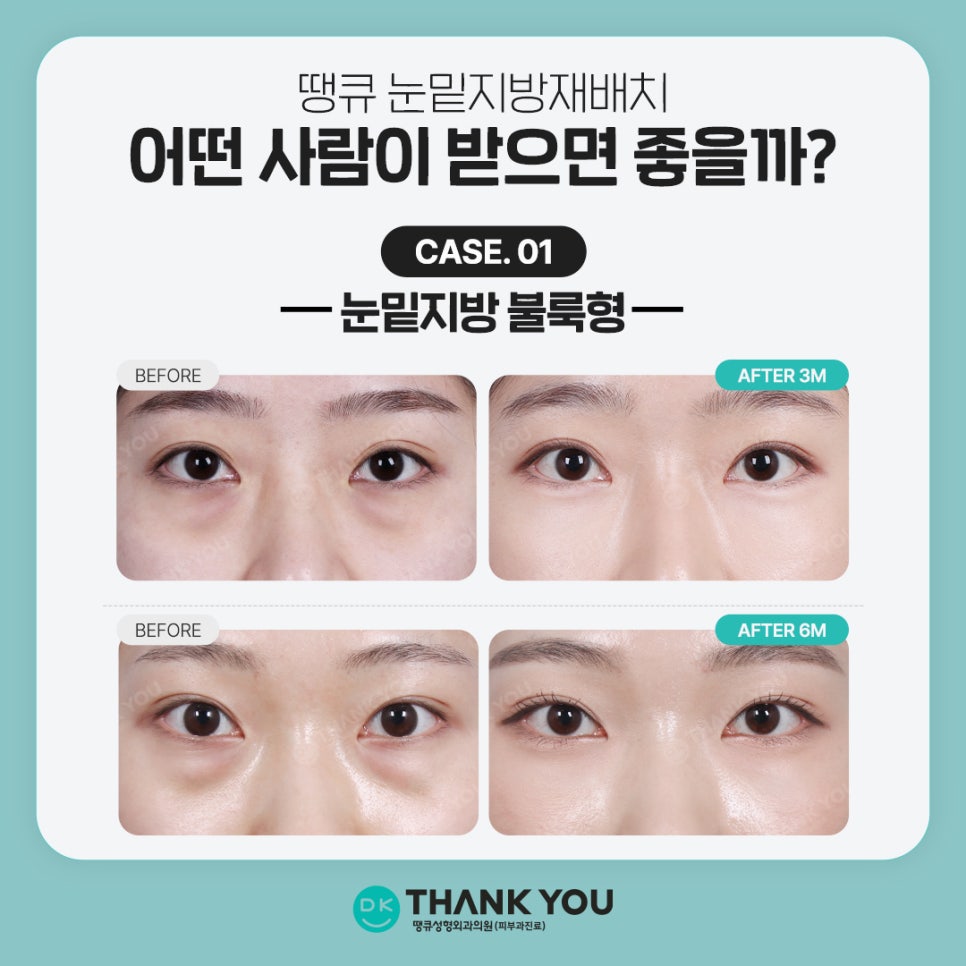 Under-Eye Fat Repositioning Event! Special Benefits for Exam Takers Prepared by Thank You 💫 image 4