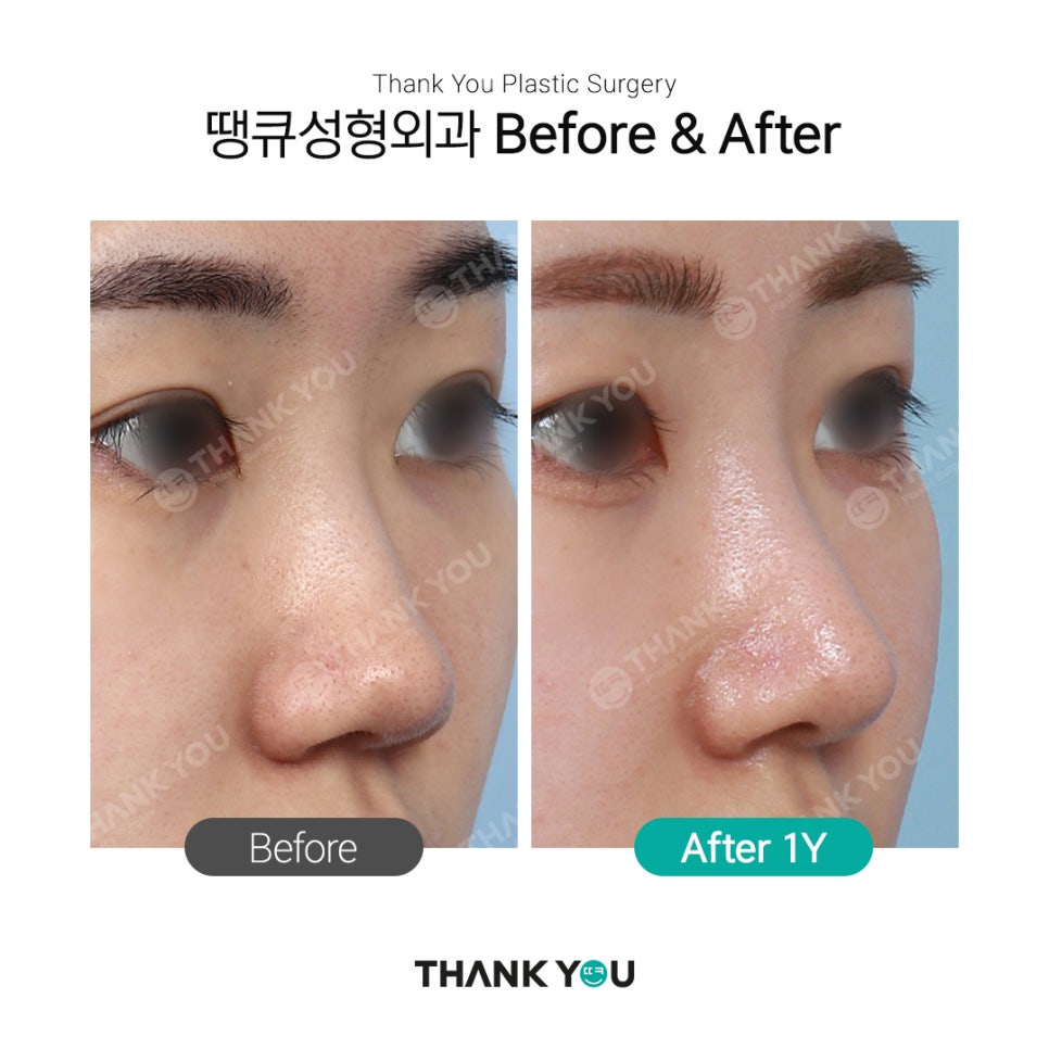 자연스러운 코?직반라인체크+코 비주란? 관련 이미지 1