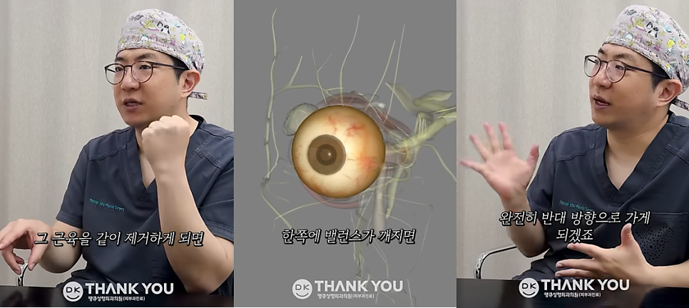 눈밑지방재배치 사시 부작용 궁금증 해소해 드립니다! 관련 이미지 4