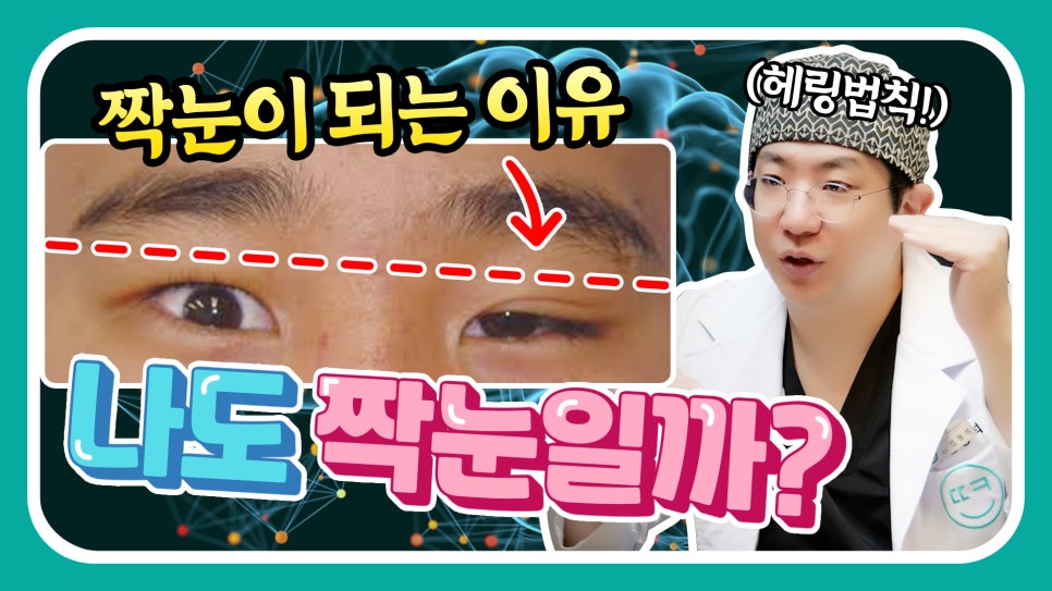 비대칭눈 교정(짝짝이 쌍꺼풀) 헤링의 법칙이란? 관련 이미지 1