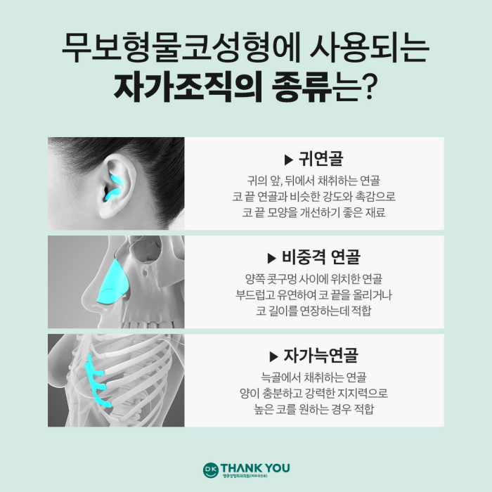 무보형물코성형 재료에 따른 특징을 알아보자! 관련 이미지 5