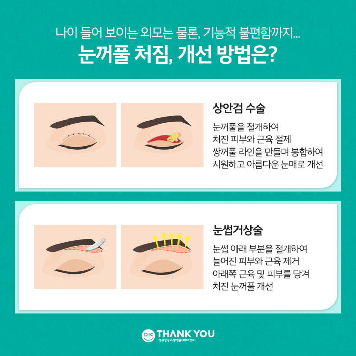 눈썹거상술 & 자연유착쌍꺼풀로 처진 눈꺼풀 효과적으로 개선! 관련 이미지 2