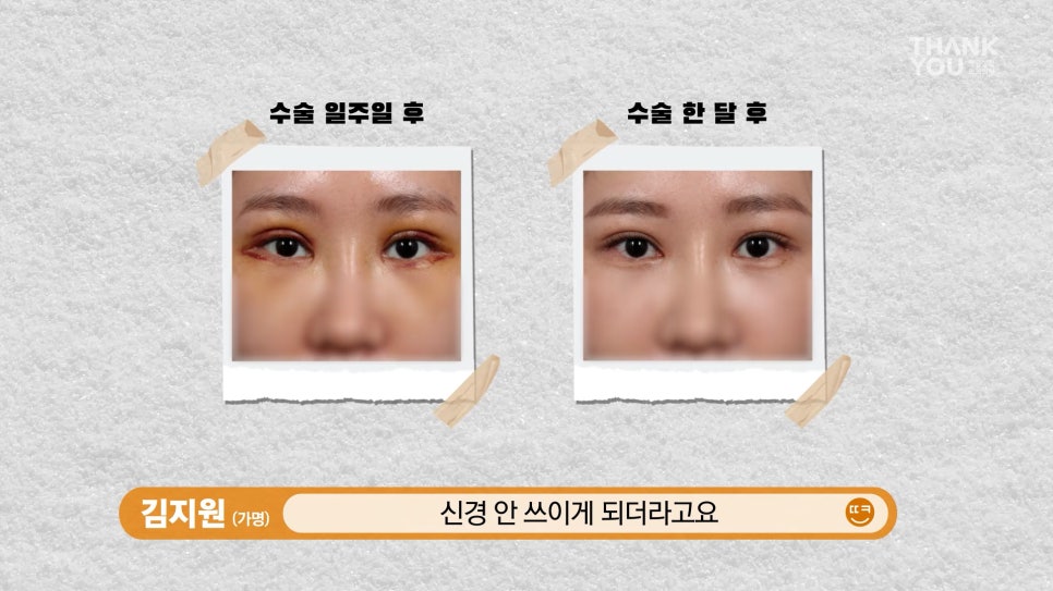 엄빠 몰래 이마거상 성공! (뒤밑트임 후기) 관련 이미지 13