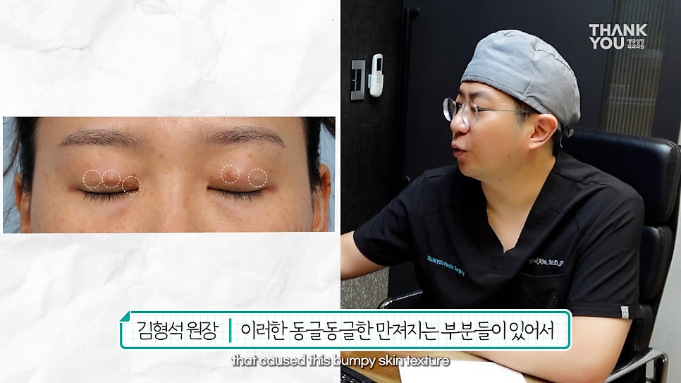 눈꺼풀에 딱딱한 여드름? 육아종 제거 [비절개] 관련 이미지 6