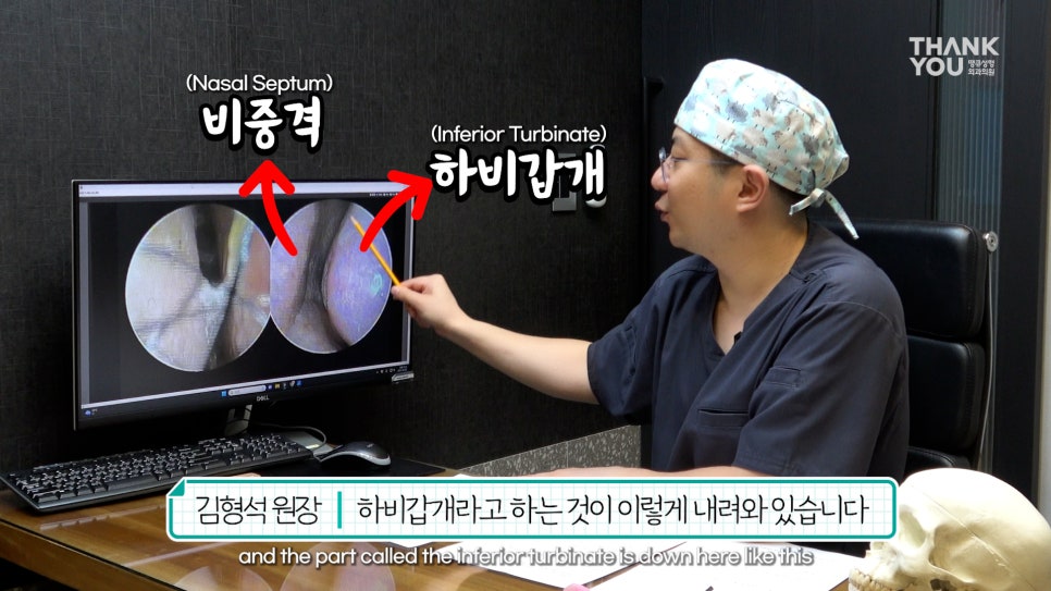2분만에 막힌 코 뻥 뚫어주는 코블레이션 [ft.비염코성형 전후] 관련 이미지 27