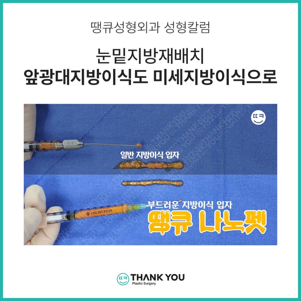 눈밑지방재배치 함께 필요한 미세 지방이식?(땡큐 나노펫) 관련 이미지 6