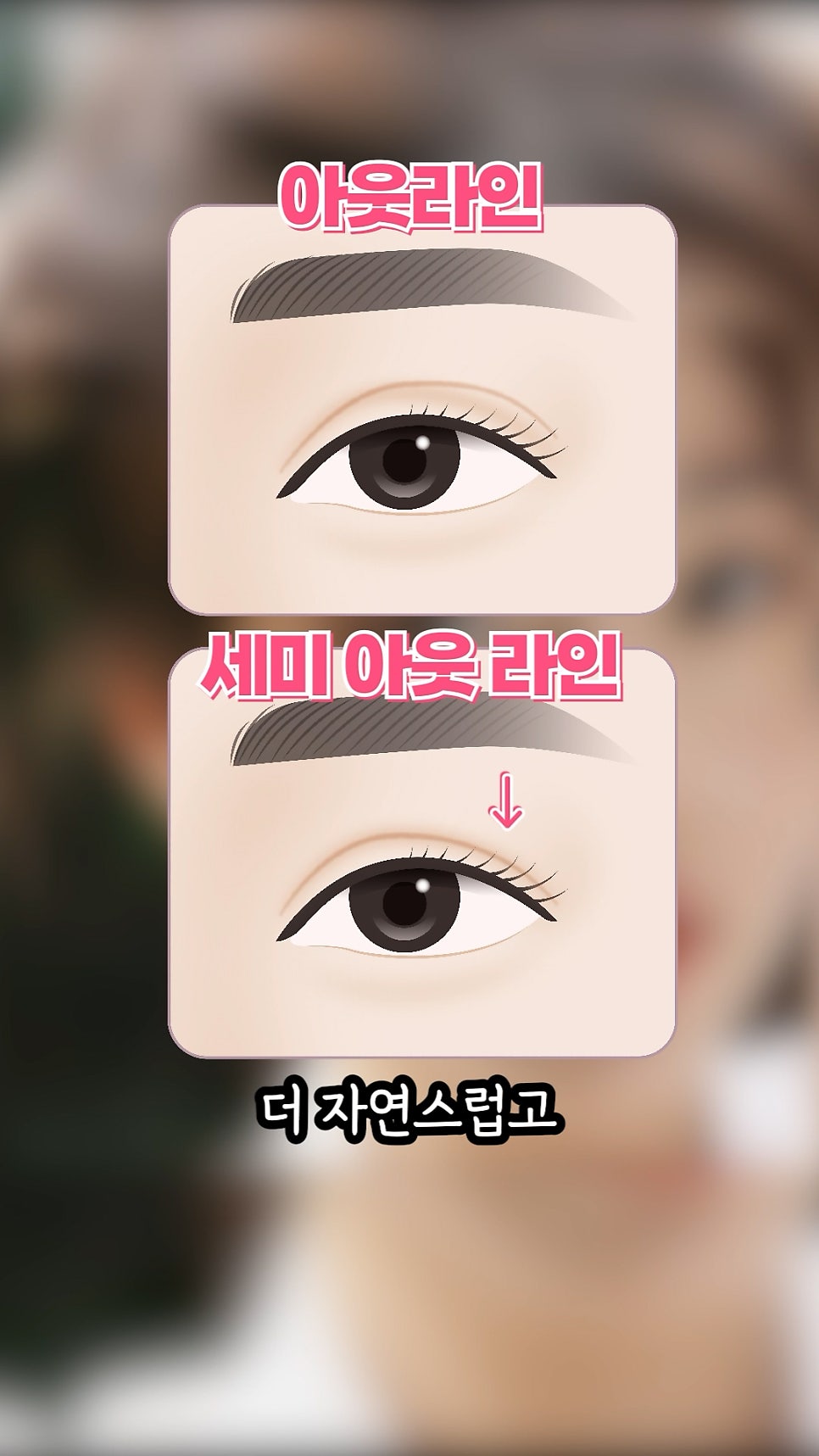 장원영 쌍수, 쌍꺼풀 라인분석 (feat.세미아웃라인) 관련 이미지 10