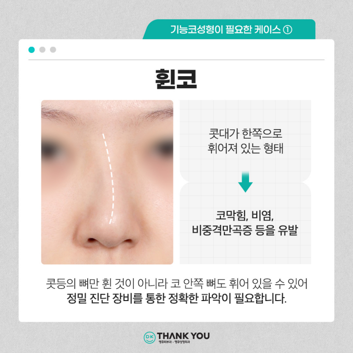 기능코수술병원에서 콧 속 불편함, 외적 스트레스 동시 해소! 관련 이미지 4