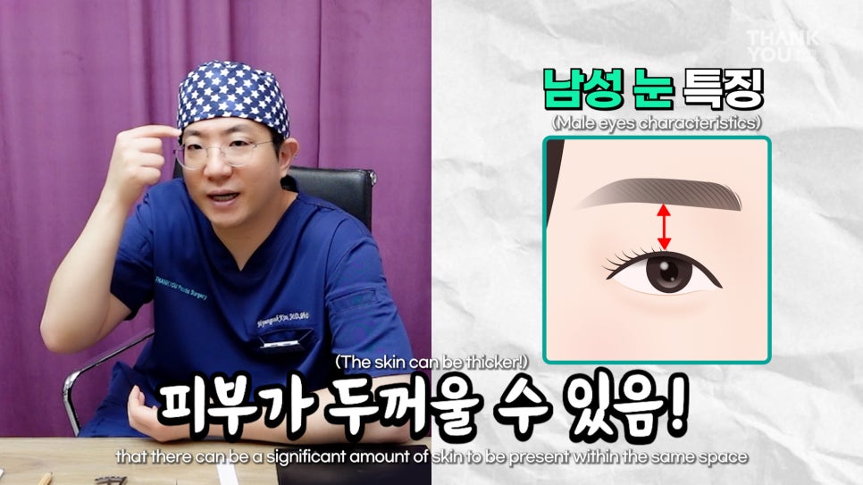 [남자 쌍수후기?] 망하기 싫으면 꼭 보세요! 관련 이미지 18