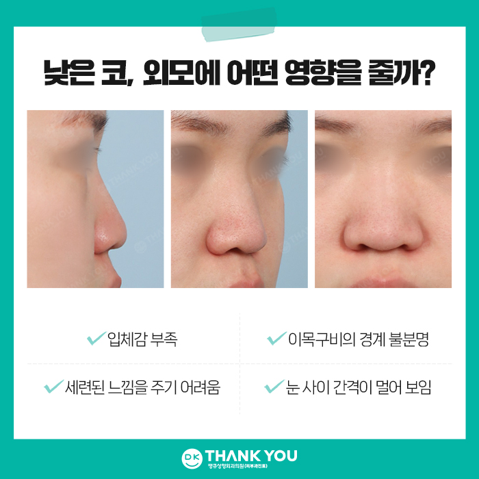 낮은코성형, 완성도 높은 결과를 얻고 싶다면 주목! 관련 이미지 2