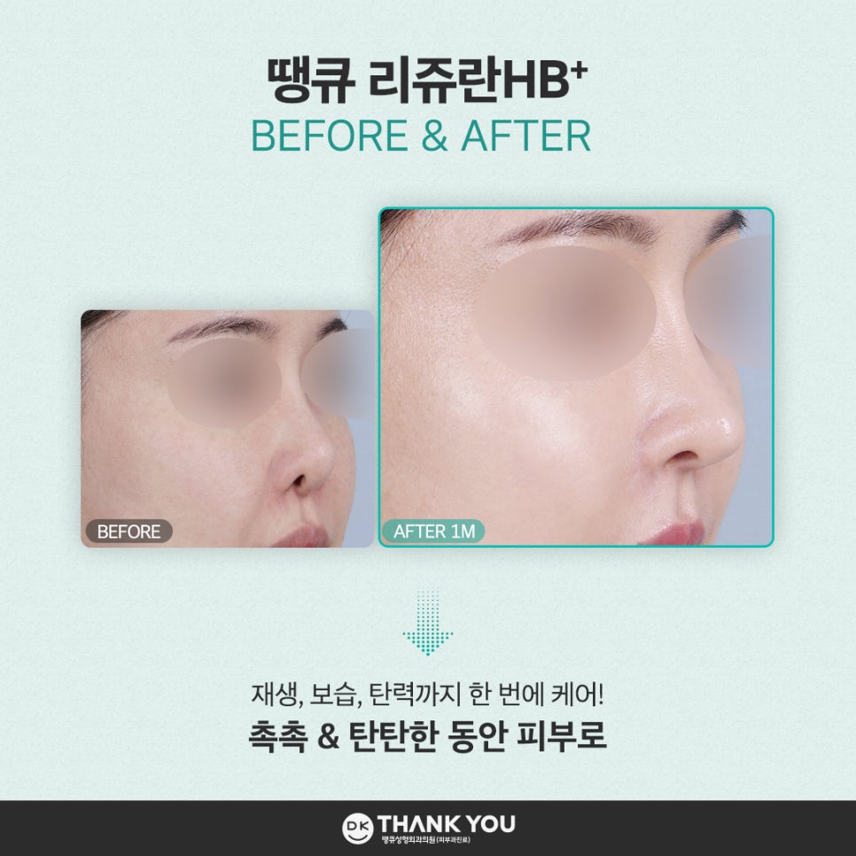 Relieve Seasonal Dryness and Fine Wrinkles at the Same Time with Rejuran HB Benefits! image 8