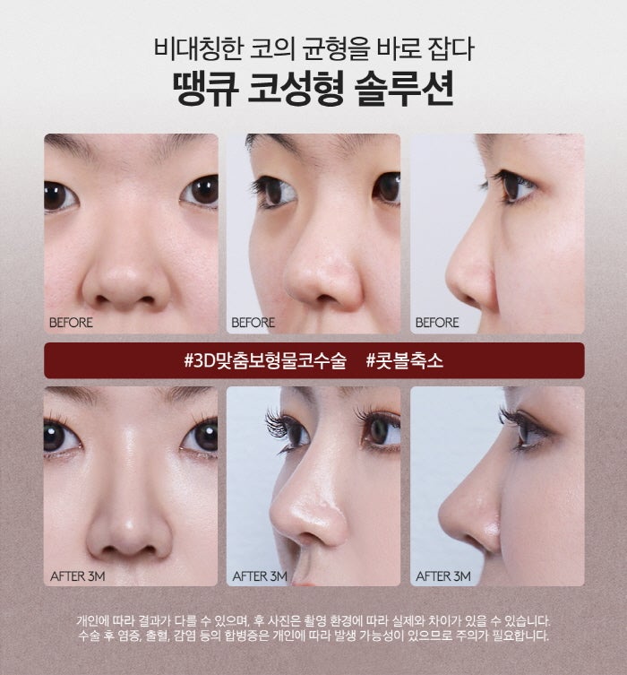 맥미걸 관련 이미지 4
