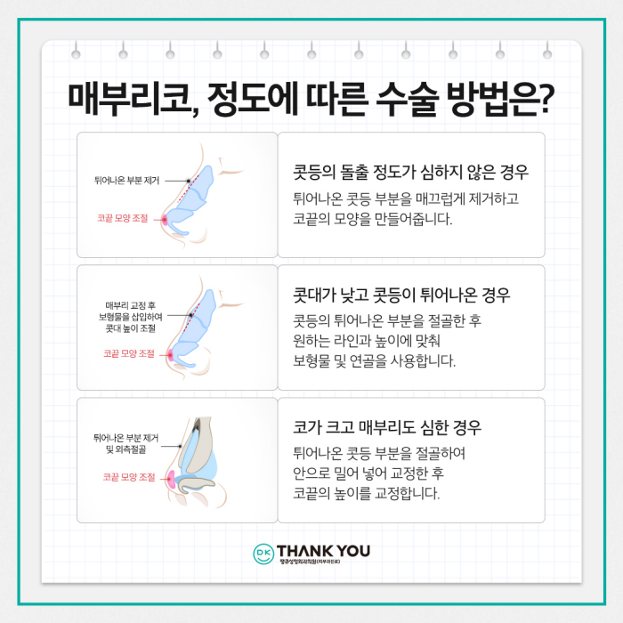 매부리코개선 맞춤 디자인으로 원하던 워너비 코 완성! 관련 이미지 6