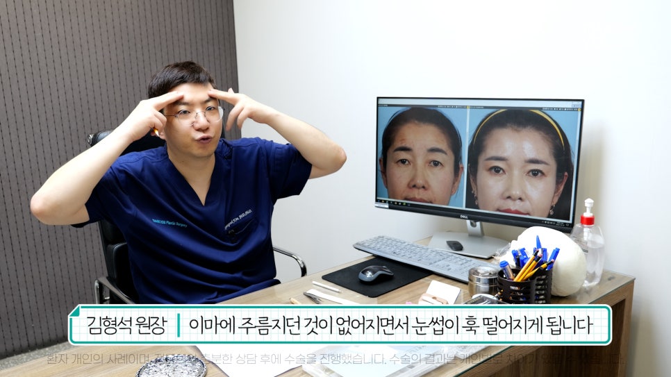 중년눈성형 전후& 이마거상+눈썹하거상+쌍수로 젊어지기 관련 이미지 20