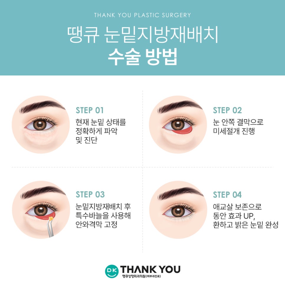 A Place That Does Lower Eyelid Fat Repositioning Well — Complete a Smooth, Refreshed Under-Eye Look at Thank You! image 6