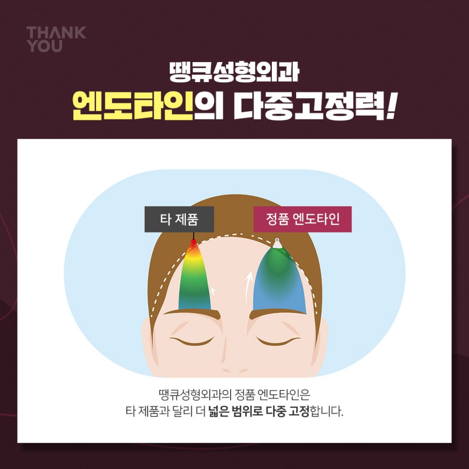 엔도타인 이마거상 찾는다면?시니어&주니어 눈썹올림술 관련 이미지 8