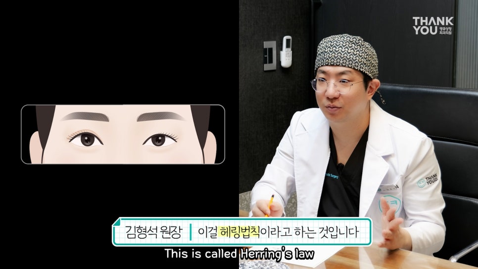 비대칭눈 교정(짝짝이 쌍꺼풀) 헤링의 법칙이란? 관련 이미지 16