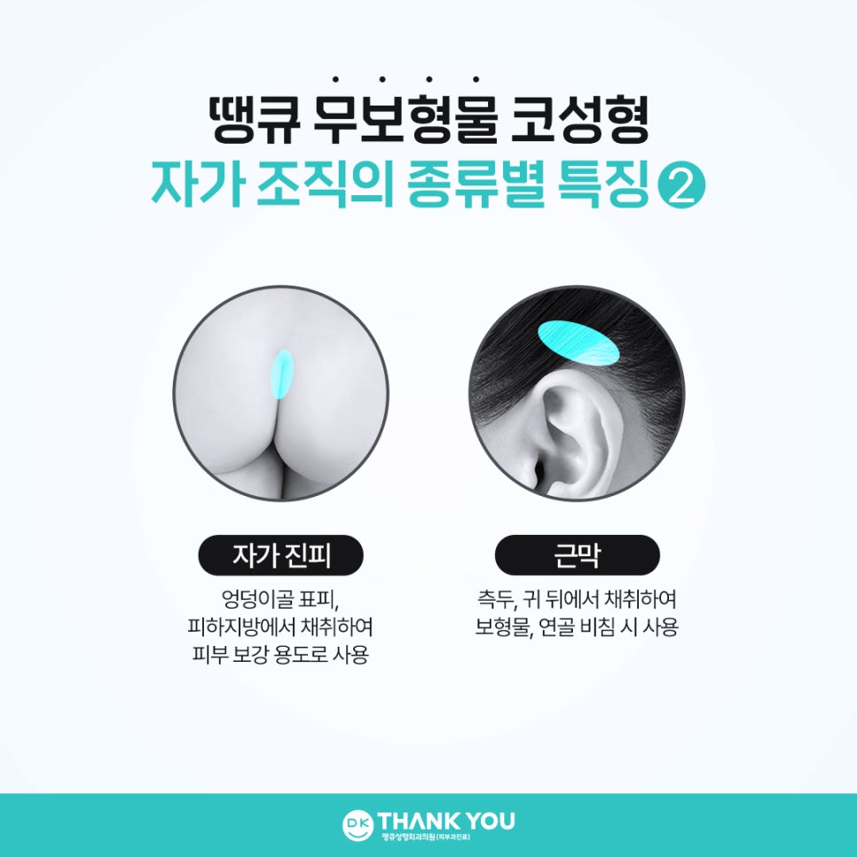무보형물코성형, 어떤 경우에 적합할까? 관련 이미지 9