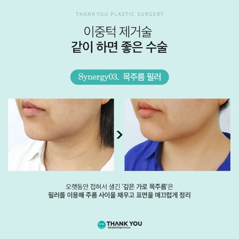Not Enough Improvement from Chin Liposuction Alone? How About Thank You Double Chin Removal Surgery?! image 15