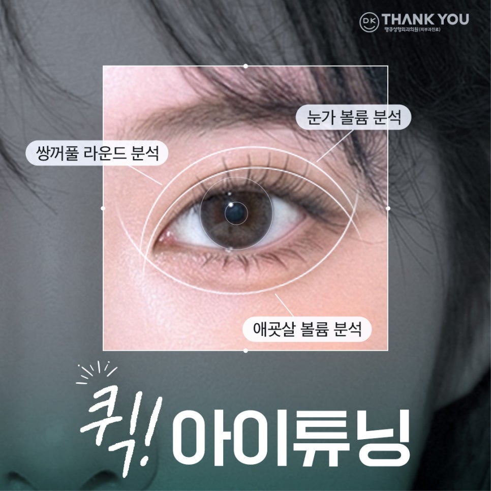 쌍꺼풀라인 절개 없이 확장하고 싶다면?! 땡큐 퀵!아이튜닝 관련 이미지 1