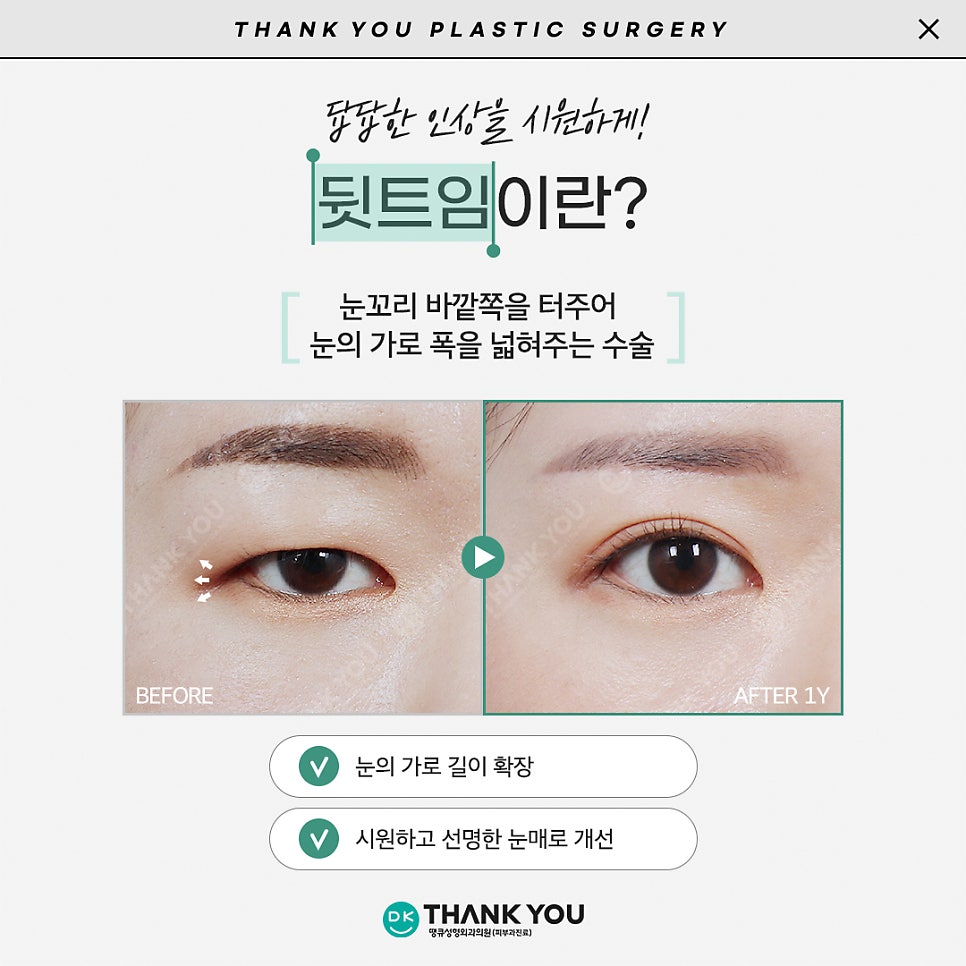 듀얼트임효과로 답답한 꼬막눈을 시원하게! 관련 이미지 3