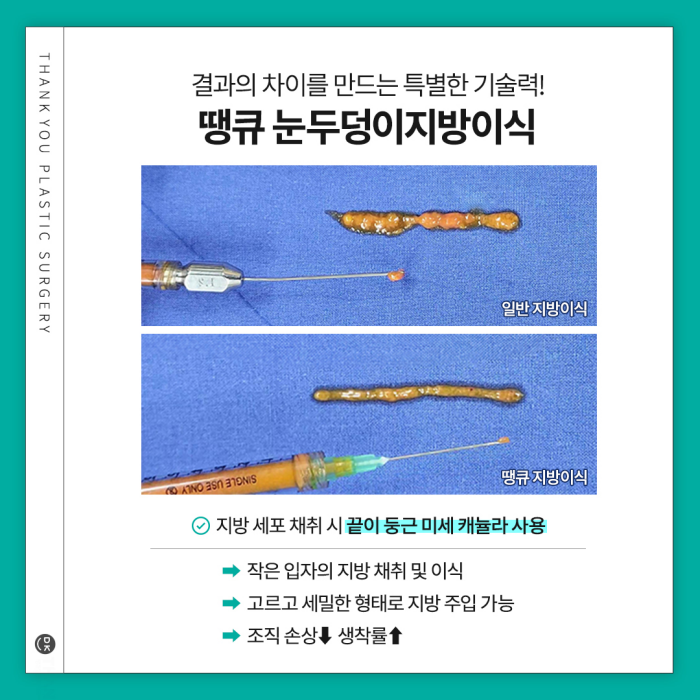 눈두덩이지방이식으로 피곤한 이미지 탈출! 생기있는 눈매 완성! 관련 이미지 6