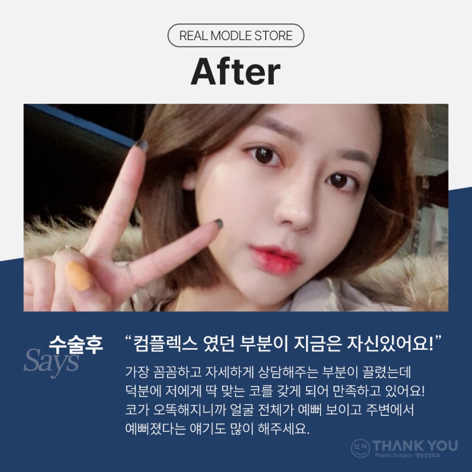 코필러 대신 여자코성형 (콧대+코끝)자연스럽게 관련 이미지 11