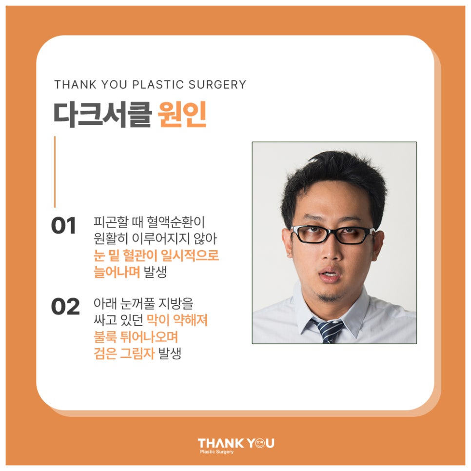다크서클 눈밑지방재배치 수술로 개선될까? 관련 이미지 3