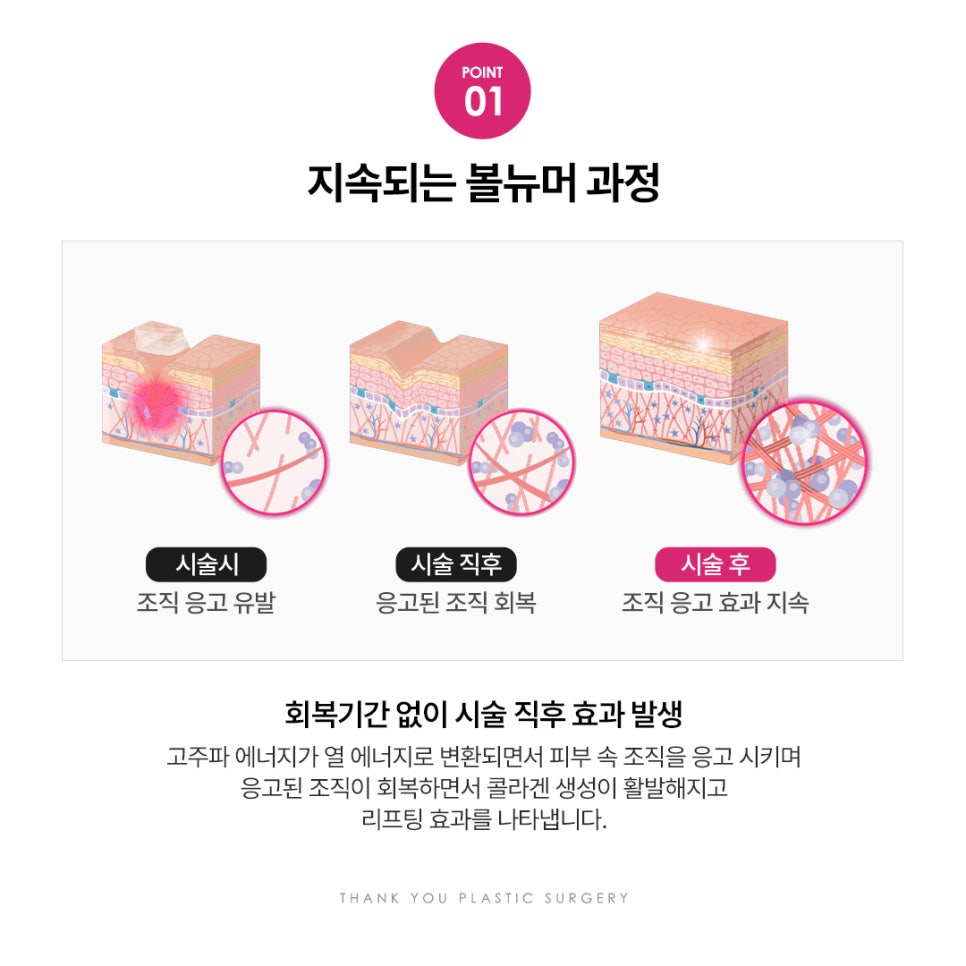 땡큐피부과 볼뉴머리프팅 EVENT ✨ 관련 이미지 4