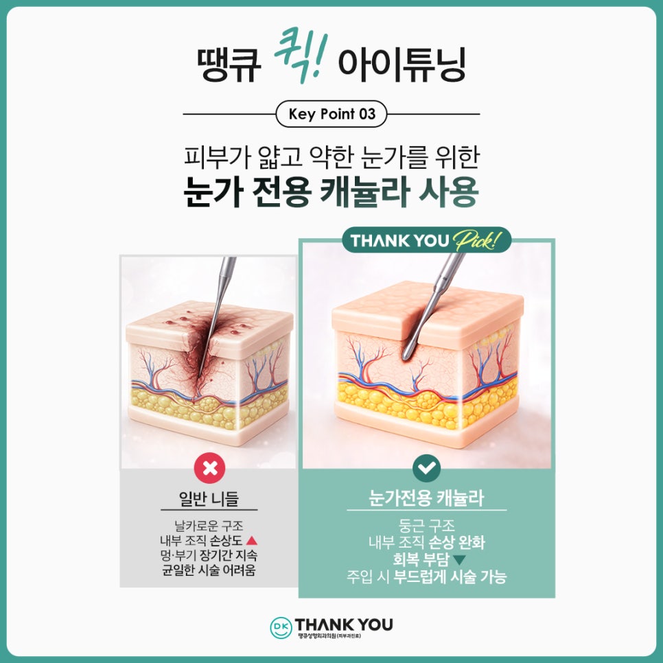 쌍꺼풀라인 절개 없이 확장하고 싶다면?! 땡큐 퀵!아이튜닝 관련 이미지 7