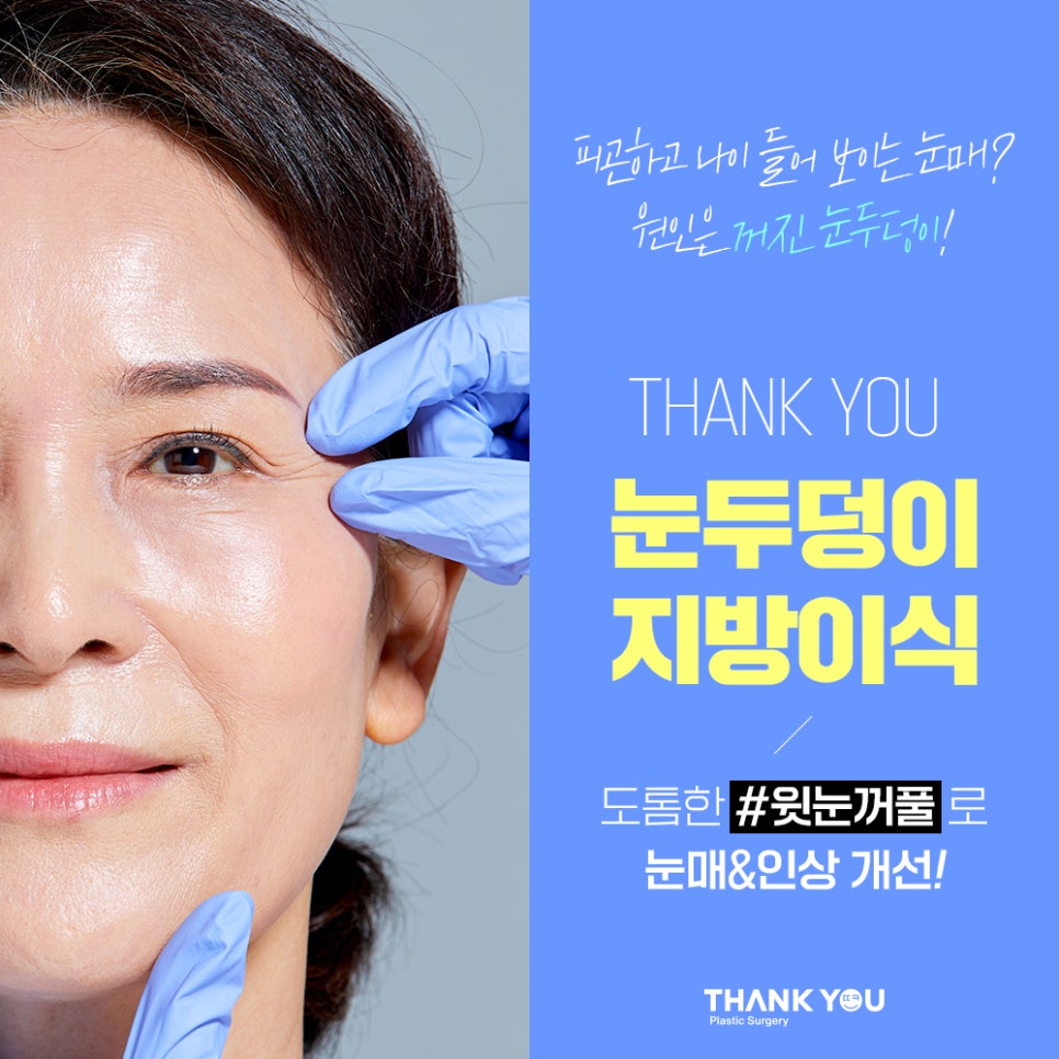 눈두덩이 지방이식, 푹꺼진 눈꺼풀에 자가지방이식으로 관련 이미지 8
