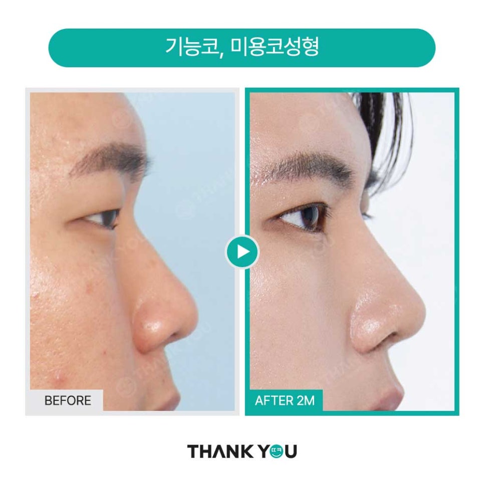 의벤져스 땡큐, 관련 이미지 9