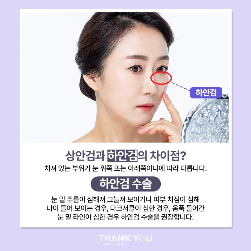 눈밑하안검수술 전후사진 확인, 땡큐 이호준 원장님 관련 이미지 5