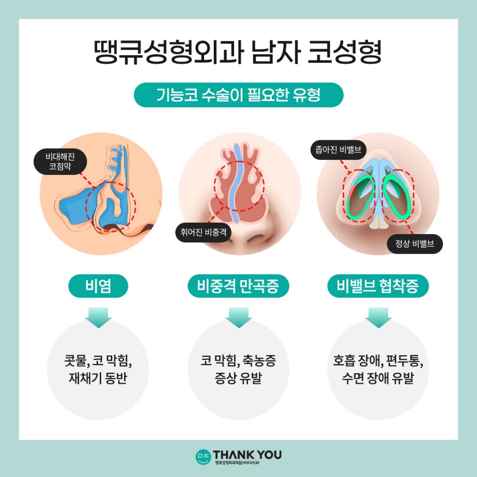 [남자코수술 전후] 코성형외과는 왜 땡큐일까?! 관련 이미지 8