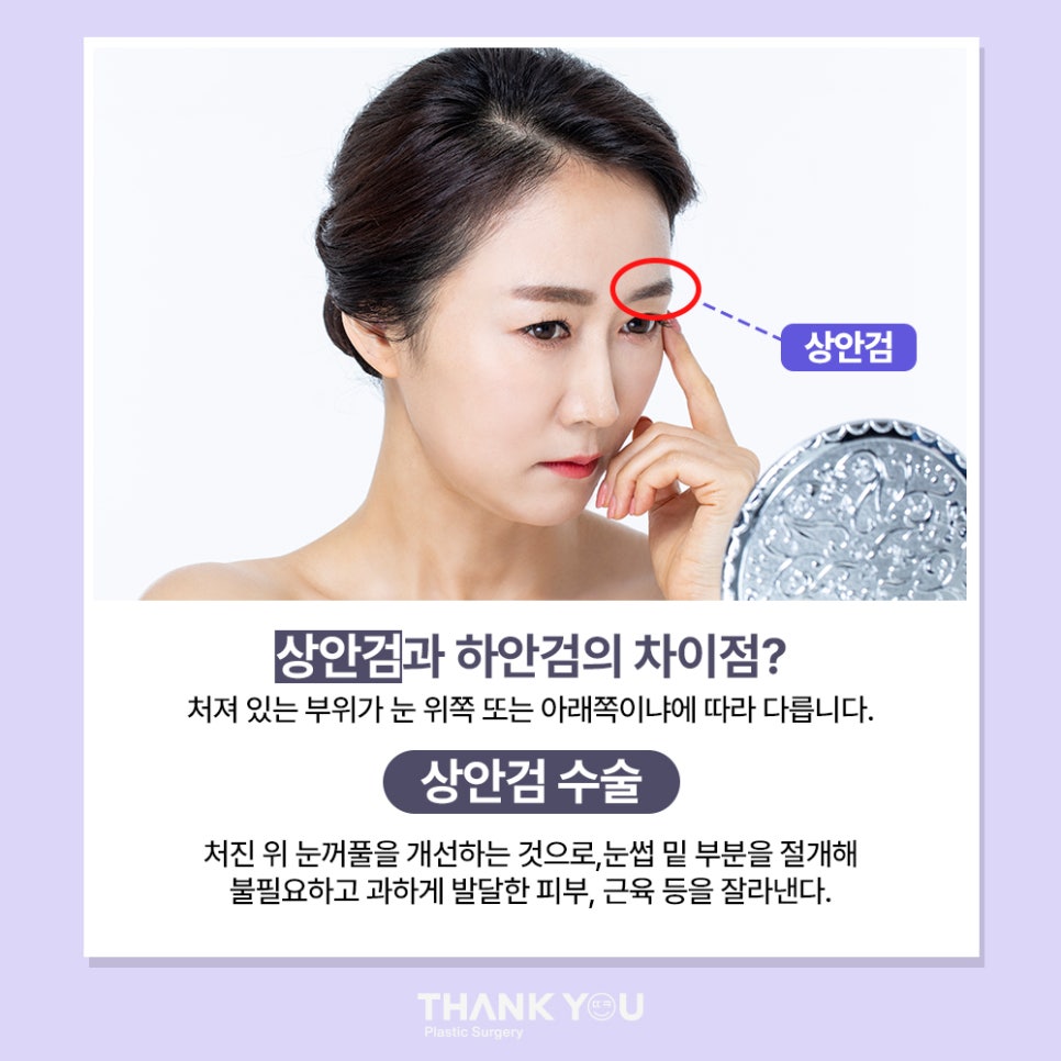 눈밑하안검수술 전후사진 확인, 땡큐 이호준 원장님 관련 이미지 3