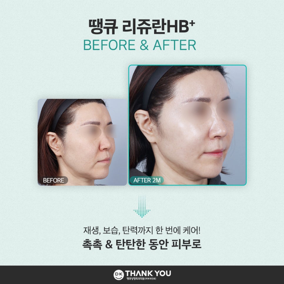 Relieve Seasonal Dryness and Fine Wrinkles at the Same Time with Rejuran HB Benefits! image 9