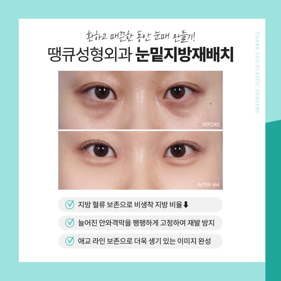 눈밑지 수술 후 얼굴처짐 생길까요? 관련 이미지 7